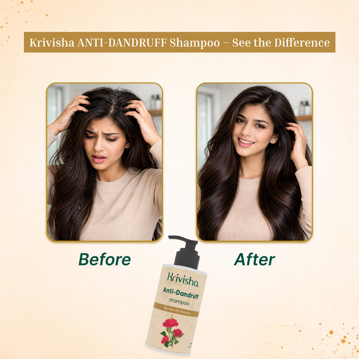 Anti Dandruff Shampoo With  Hibiscus &Aloevera For Suitable For All Hair Types